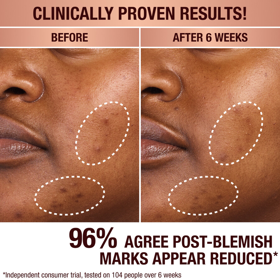 dark spot serum charlottes magic cream duo